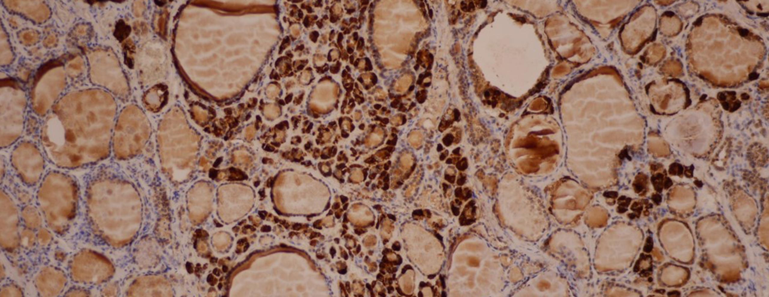 Tumore der Hypophyse Infos aus Mainz Endokrinologe für Mainz und