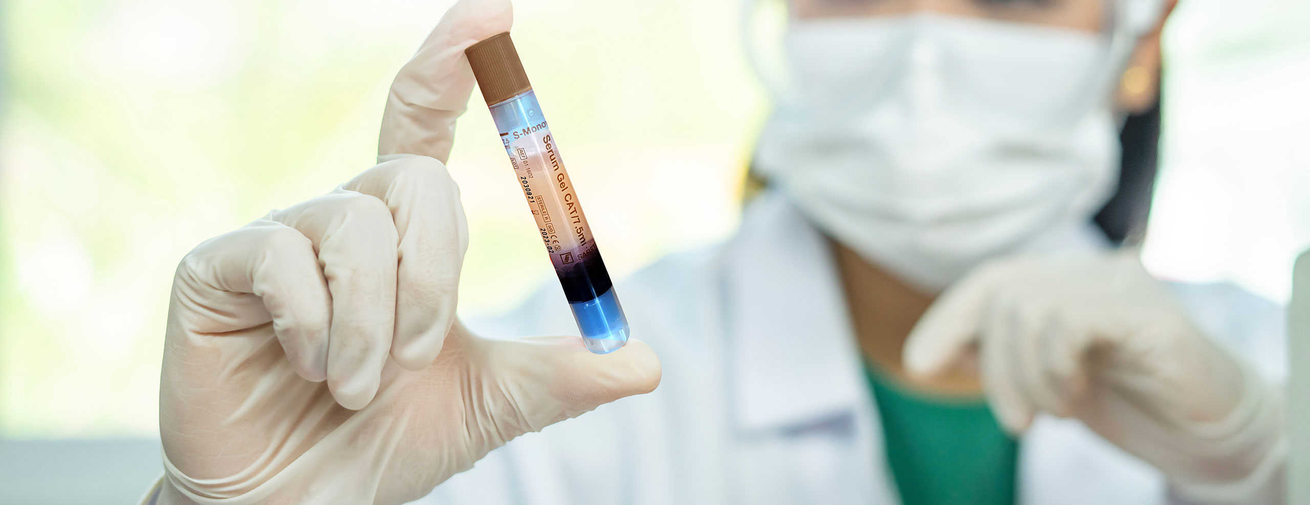 Fettstoffwechselstörungen medikamentös Blutfettwerte senken